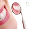 5 Interesting Facts about Teeth Whitening - By Cocobaci 15 Day Oil Pulling Program