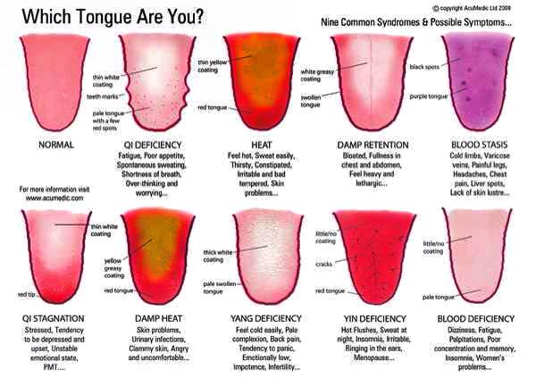 Colour of your tongue